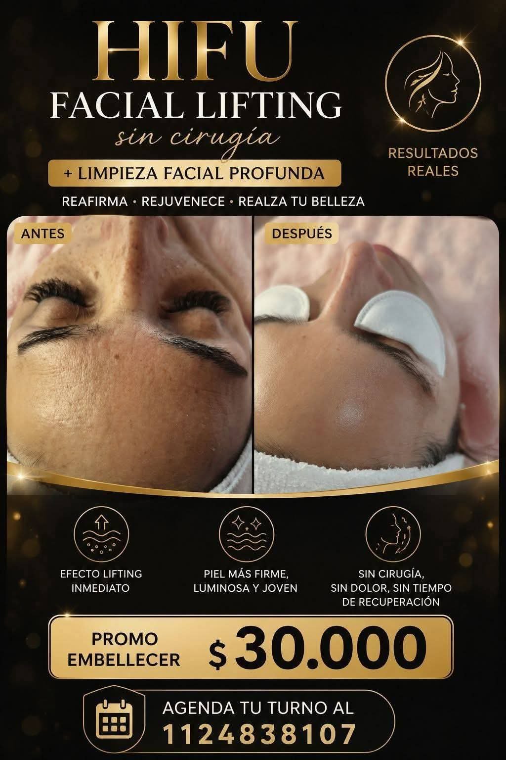 Especial de la semana - Limpieza Facial + Hidratante