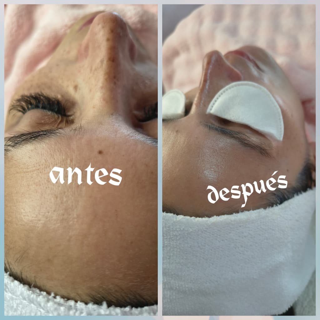 Resultado real antes y después - Andrea Style